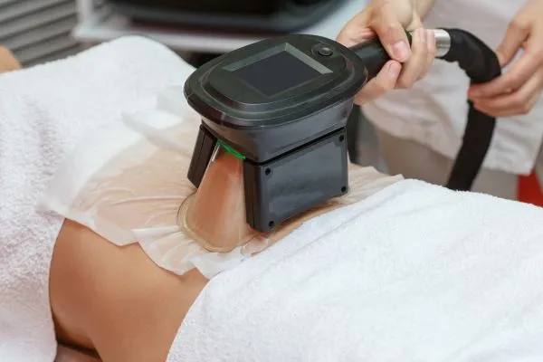 Image of person having fat freezing treatment to help weight gain Coatbridge