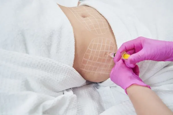 image of fat dissolving injections on love handles to help combat weight gain Coatbridge