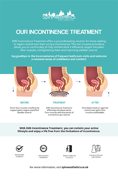 image of how urge incontinence Coatbridge treatment works