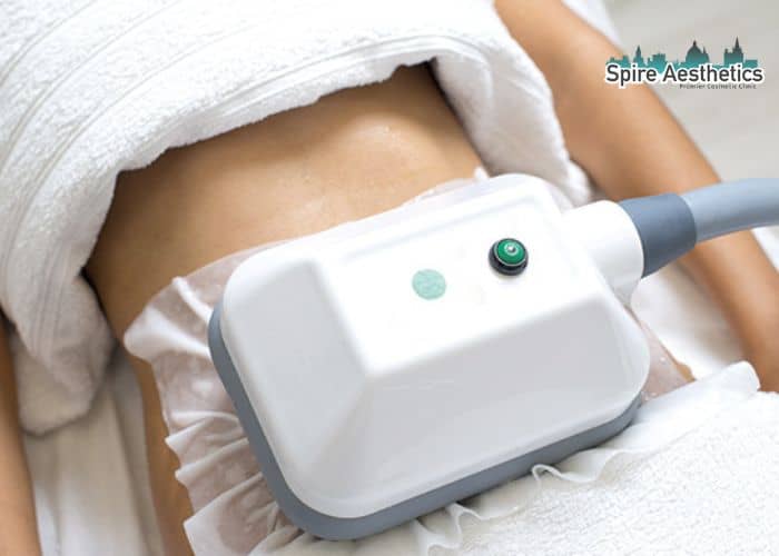 Shift Those Extra Pounds: How Fat Freezing Can Help You Slim Down Coatbridge