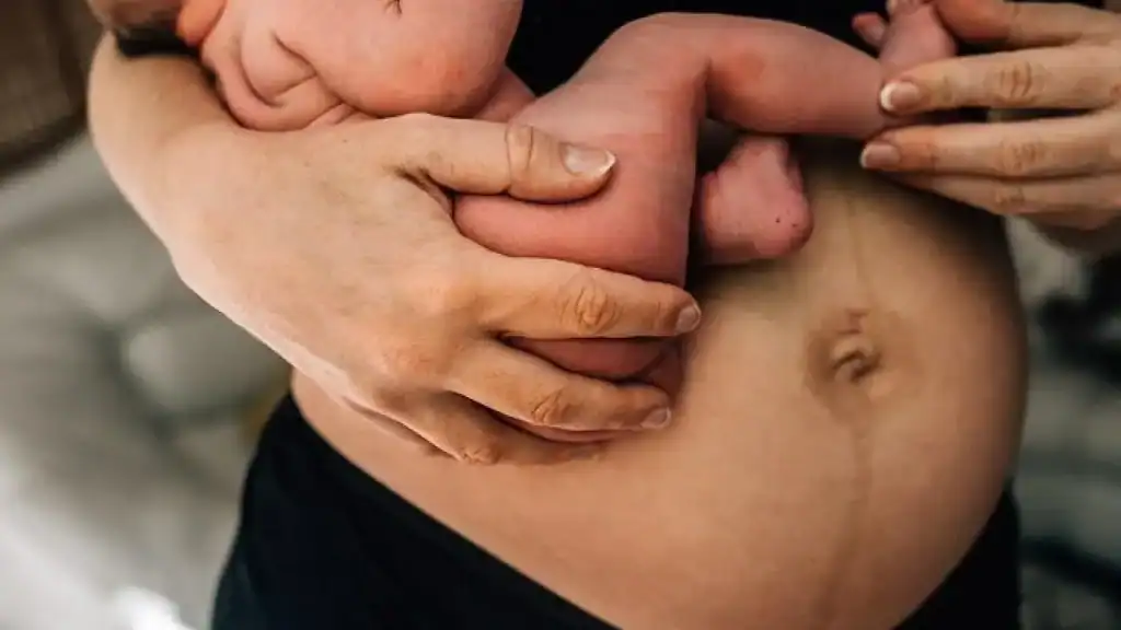 Why Is My Stomach Still Big After Pregnancy Coatbridge?